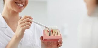 WHAT ARE DENTAL IMPLANT IN DENTISTRY?